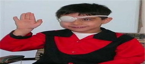 غربالگری چشم کودکان