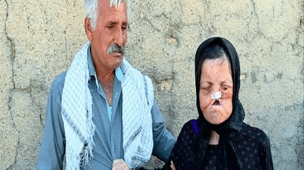 روستایی که در یک روز عزادار ۲۷۵ نفر شد