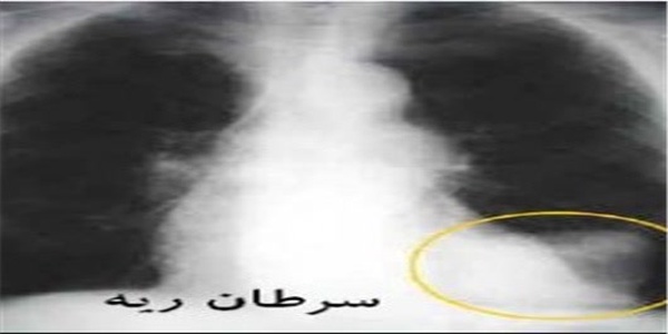 ،