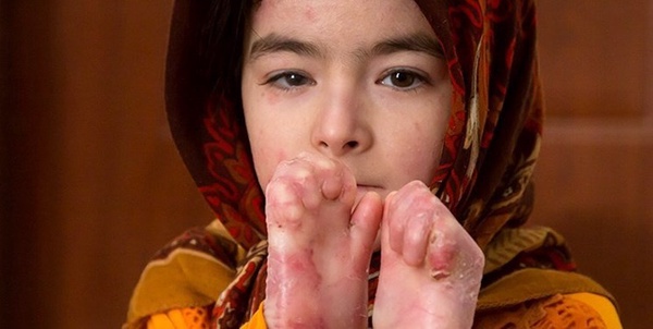 پروانه ای