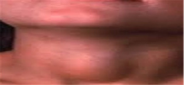 تیروئید