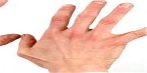 خشکی پوست
