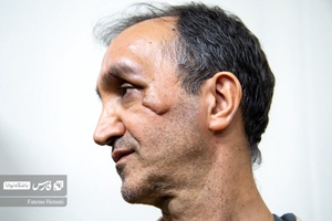 حضور یکی از مجروحان که توسط متهمان مصدوم شده بود