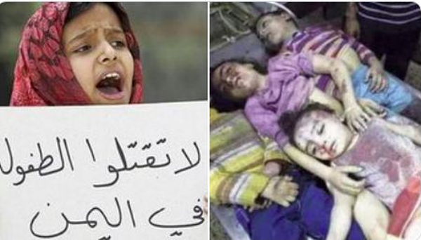 کودک یمنی یمن کشتار